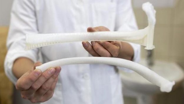 Успешно пресадено првото 3Д печатено ребро во светот